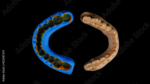composition of dental model and impression made of silicone, top view on a black background