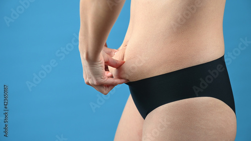 A woman's body with folds on the stomach, a woman's hands hold a saggy stomach photo