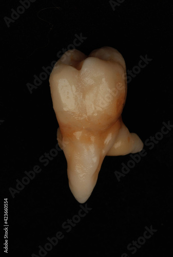 human tooth made of dental porcelain