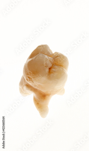 human tooth made of dental porcelain