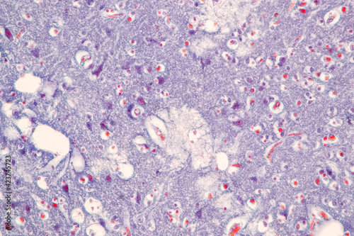 Education Spinal cord, Nerve, Cerebellum, Cortex and Motor Neuron Human under the microscope in Lab.
 photo