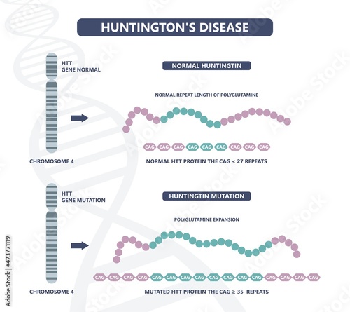 Huntington parkinson Motor alzheimer neuron brain DNA gene nerve cell juvenile problem defect genetic basal ganglia neuro repeat mutant damage testing defective mood inherits system family memory loss