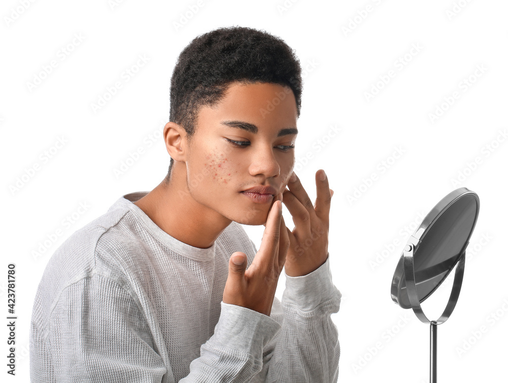 African-American teenage boy with acne problem on white background African-American teenage boy with acne problem on white background
