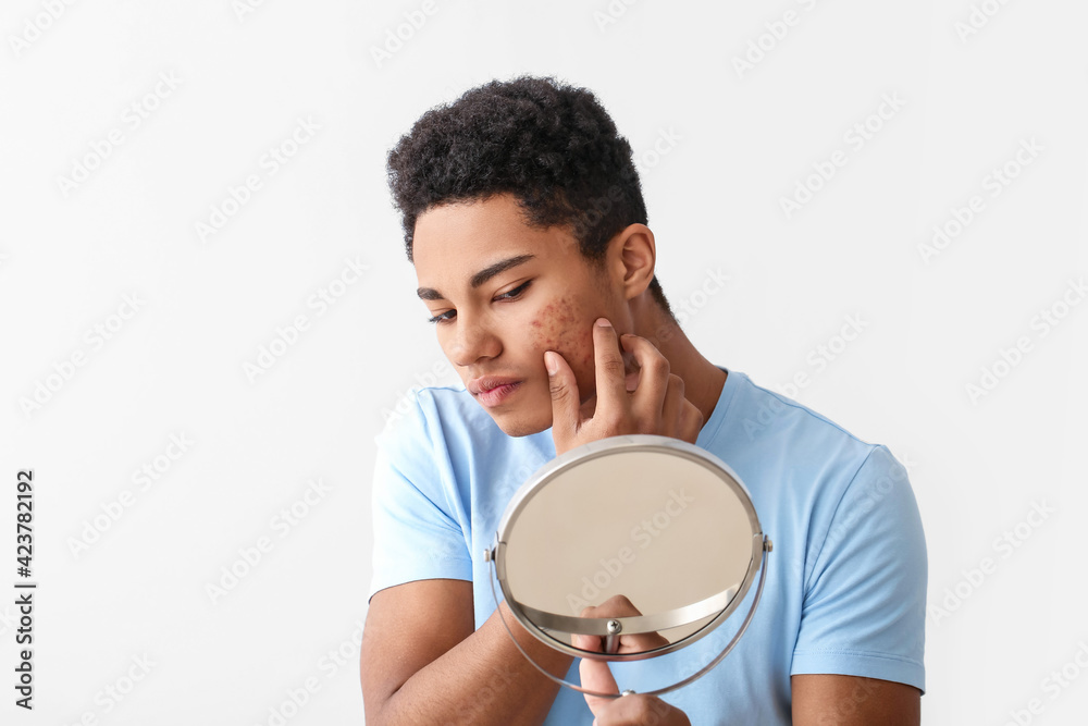 African-American teenage boy with acne problem on light background African-American teenage boy with acne problem on light background