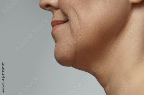 Photos Closeup of female chin and neck with expression lines
