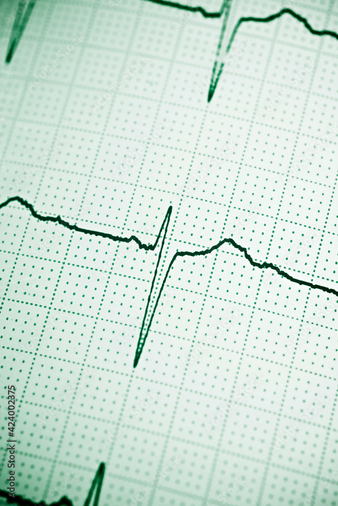 Electrocardiogram close up