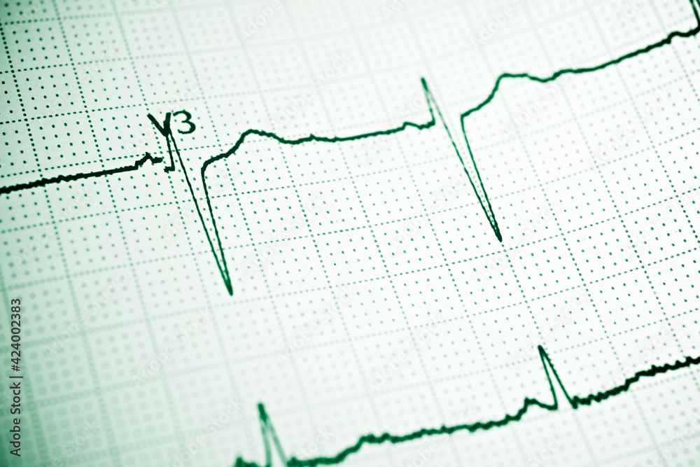 Electrocardiogram close up Electrocardiogram close up