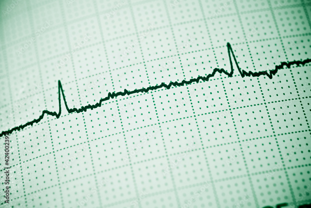 Naklejka premium Electrocardiogram close up