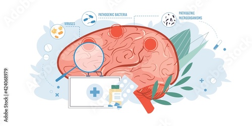 Vector cartoon flat brain,pills,medical symbols with viruses bacteria microorganisms-human anatomy internal organ desease,medical treatment diagnostics and therapy concept