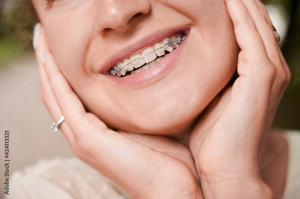 Cropped portrait of a pretty girl, smiling and demonstrating her teeth with ceramic and metal braces Cropped portrait of a pretty girl, smiling and demonstrating her teeth with ceramic and metal braces