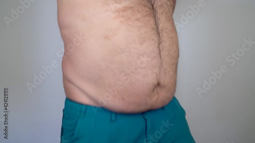 man shows his big belly and shakes his fat folds. problems of poor nutrition and obesity. fat guy performs a belly dance. Losing Weight Day