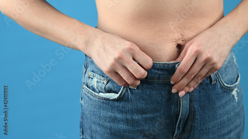 Woman in jeans show off the belly after birth and weight loss. Stretch marks on blue background with copy space © Tatsiana