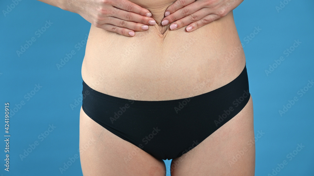 A woman pulls the skin on her stomach on blue background. Plastic surgery concept. A woman pulls the skin on her stomach on blue background. Plastic surgery concept.