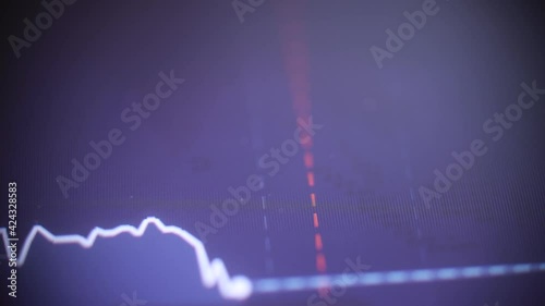 Stock market graph on computer screen - macro view. Stock market concept.