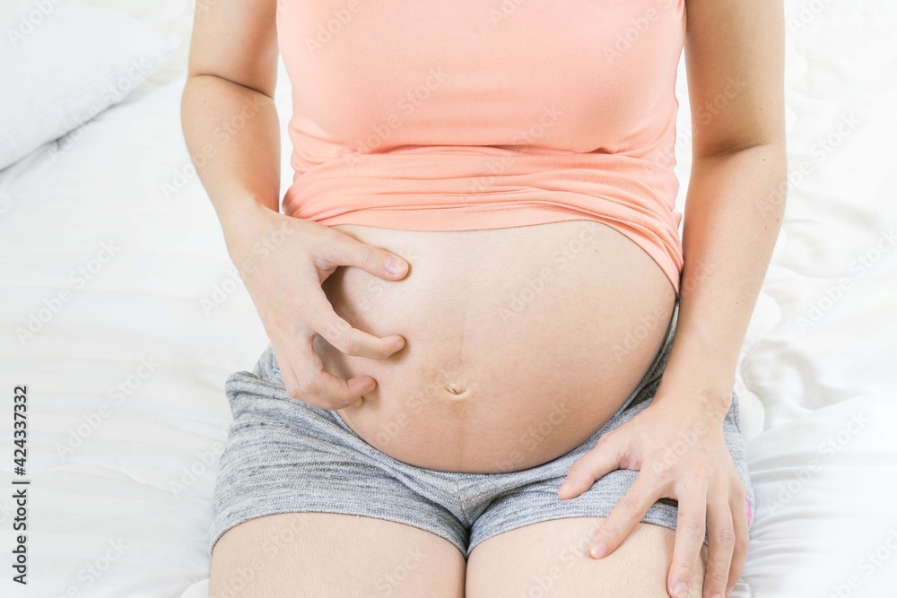 Pregnant woman scratching her belly sitting on bed at home Skin problems and pores in teenagers. Pregnant woman scratching her belly sitting on bed at home Skin problems and pores in teenagers.