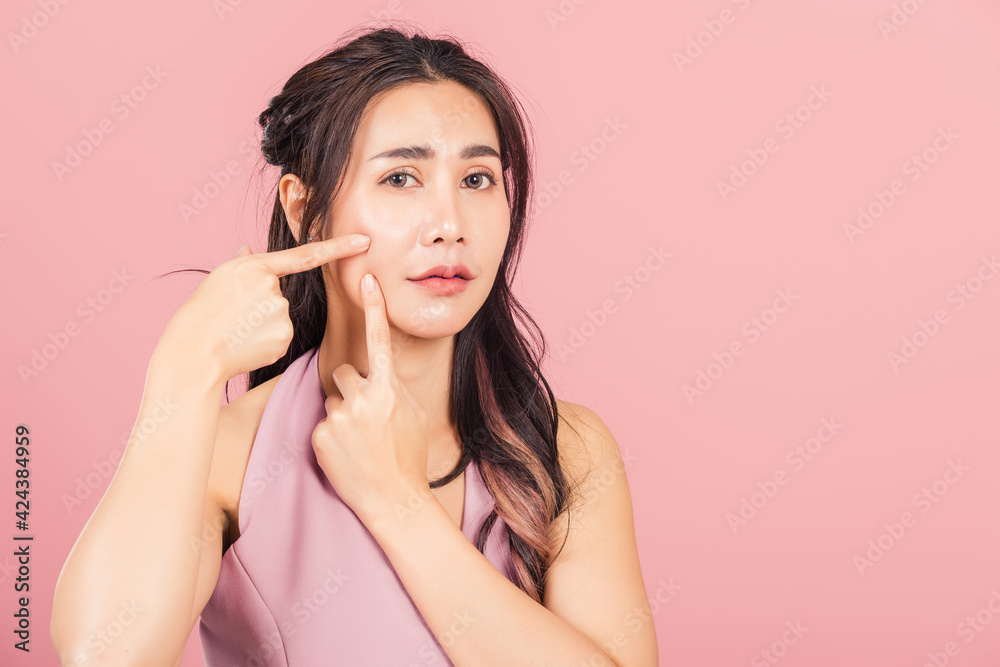 woman having skin problems squeezing pimples on her face woman having skin problems squeezing pimples on her face