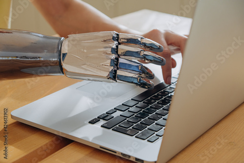 Foto Young woman uses modern metal bionic arm to type on laptop keyboard sitting at w