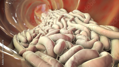 Εκτύπωση καμβά Parasitic worms in the lumen of intestine, growth and multiplication of nematode