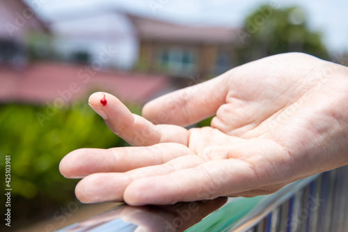 Finger with drop of fresh blood. A finger on right human hand is cut hurt and bleeding with bright red blood on blurred natural background. Man cut his finger while cooking a dinner in his kitchen.