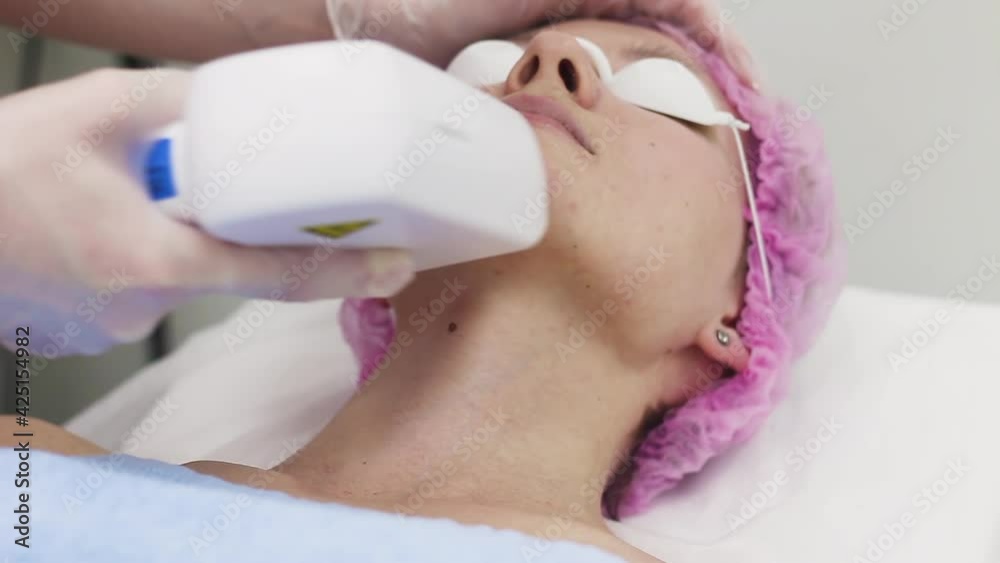 Laser IPL device in the hand of a cosmetologist. Hair removal on a woman's face. Hardware cosmetology