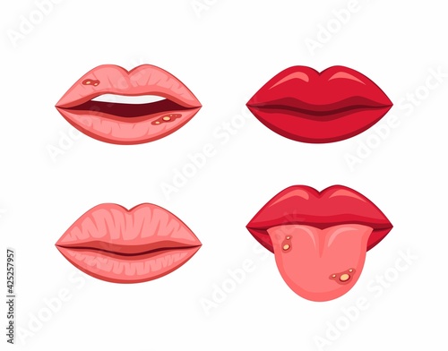 Mouth lips with tongue healthy and disease ulcer stomatitis symbol dental clinic health concept in cartoon illustration vector