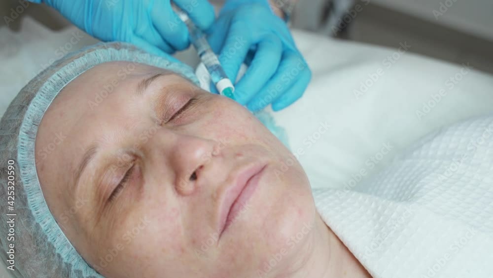A cosmetologist at a beauty salon makes an injection of hyaluronic acid into the skin of an adult woman's face. Mesotherapy, biorevitalization. Cosmetology. A cosmetologist at a beauty salon makes an injection of hyaluronic acid into the skin of an adult woman's face. Mesotherapy, biorevitalization. Cosmetology.
