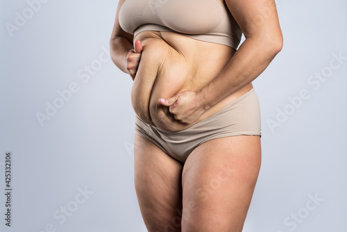 Tummy tuck, flabby skin on a fat belly, plastic surgery concept