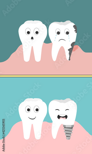 teeth happy   teeth sad.Dental implant structure medical pictorial educative graphic poster. teeth and tooth concept of Dental line cartoon style.