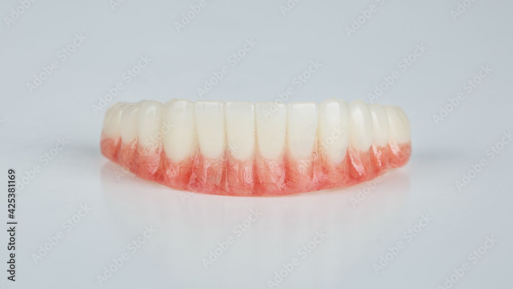 temporary denture of the lower jaw with a red gum on a white background temporary denture of the lower jaw with a red gum on a white background