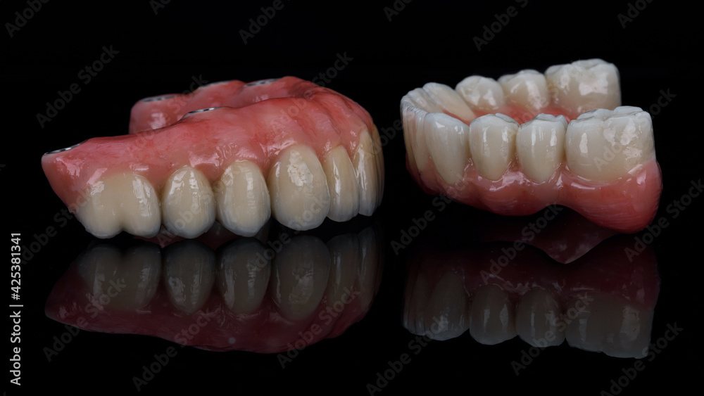 composition of two dental prostheses made of titanium and ceramic on a black background with reflection composition of two dental prostheses made of titanium and ceramic on a black background with reflection