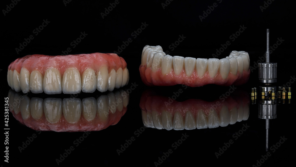 composition of the denture of the upper and lower jaws, an orthopedic screwdriver and gold screws on black glass composition of the denture of the upper and lower jaws, an orthopedic screwdriver and gold screws on black glass
