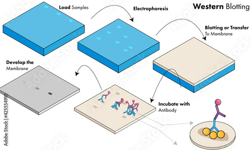 Biochemical experiment of western blotting: protein analysis by electrophoresis in agarose gel.