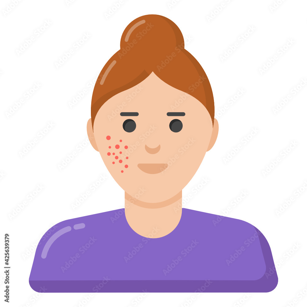 
Famneal acne skin icon, flat design of pimples 

