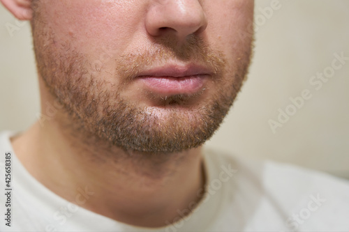 The beard of a light blond-haired man.