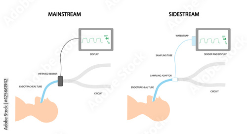 Capnography. Difference between Mainstream and Sidestream technologies