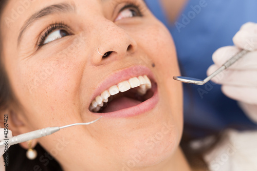 Close up view of dentist treating teeth of hispanic woman in dentist office