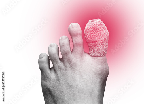 close up of woman right foot with a wounded on big toe. Isolated on white background. Accident and health care concept. Black and white tone with res light on toe.