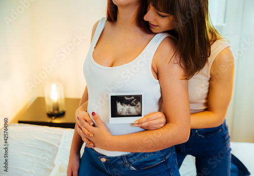 Lesbian couple holding ultrasound scan of baby on pregnant belly girlfriend on bed - Surrogate mothers concept photo