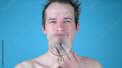 Young man shows irritation on his face through a magnifying glass 