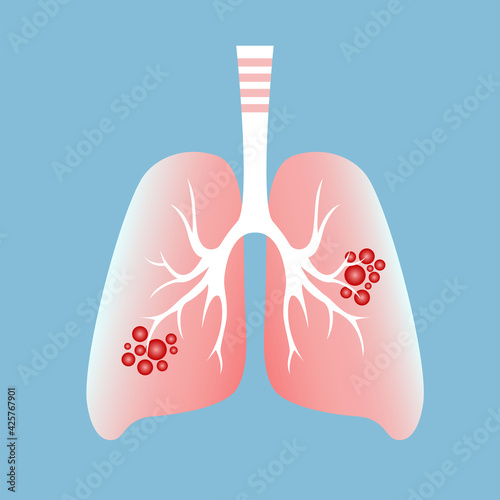 Cancer lung isolated on white background. Lungs technology logo design vector. Lung cancer vector concept repiratory disease. Human lung cancer icon.