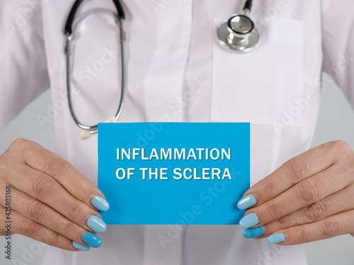 Medical concept meaning INFLAMMATION OF THE SCLERA Scleritis with phrase on the page. photo