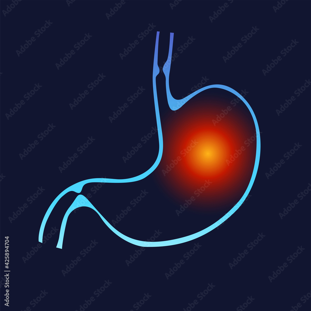 Stomach heartburn. Stomach pain, gastritis, indigestion, vomiting
