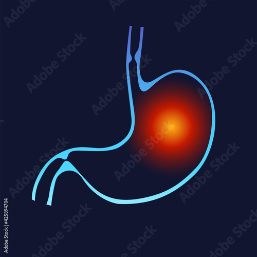 Stomach heartburn. Stomach pain, gastritis, indigestion, vomiting, heartburn problems. Heartburn and Gastritis isolated. The concept with indigestion and stomach pain problems. Vector flat