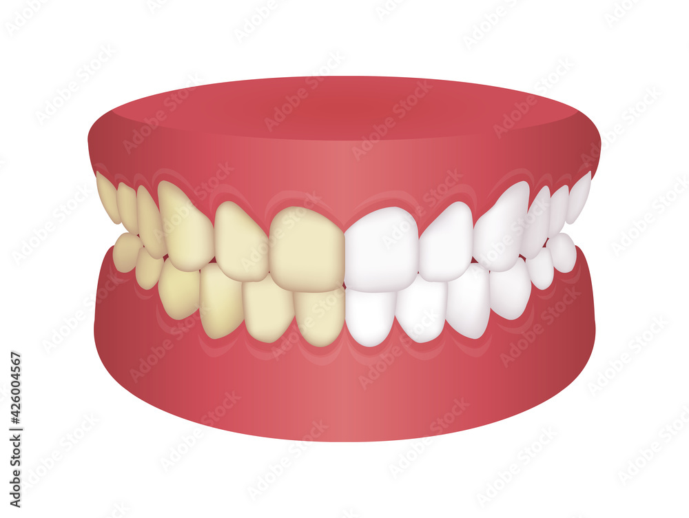 Obraz premium Teeth whitening vector illustration / before and after