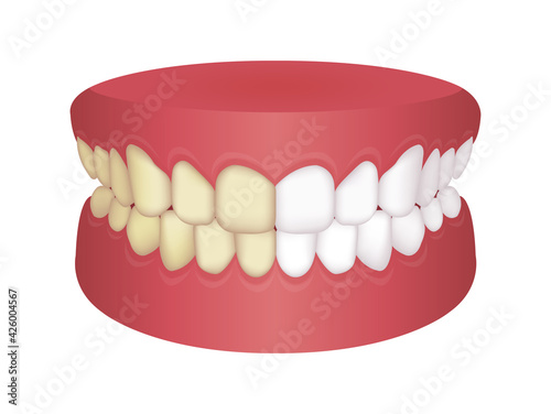 Teeth whitening vector illustration / before and after