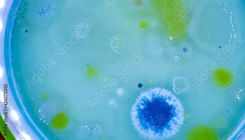 Colonies of microorganisms in a petri dish photo