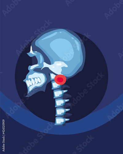 skull with spine
