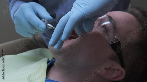 Close Up of Male Dentist Hands Working on the Teeth of a Caucasian Young Man photo