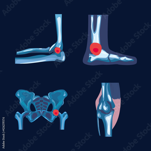 Rheumatology icon set