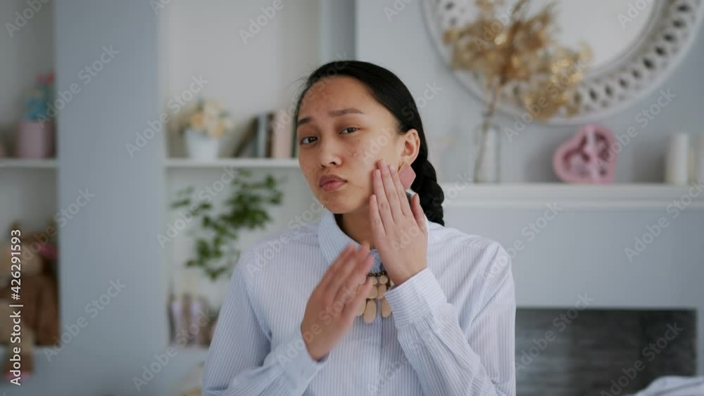 Young Asian Beautiful Girl with problem skin. Acne treatment stages - 13th day of 28. Young Asian Beautiful Girl with problem skin. Acne treatment stages - 13th day of 28.